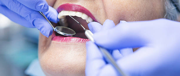 Best Pediatric Emergency Dentist in Thousand Palms, CA